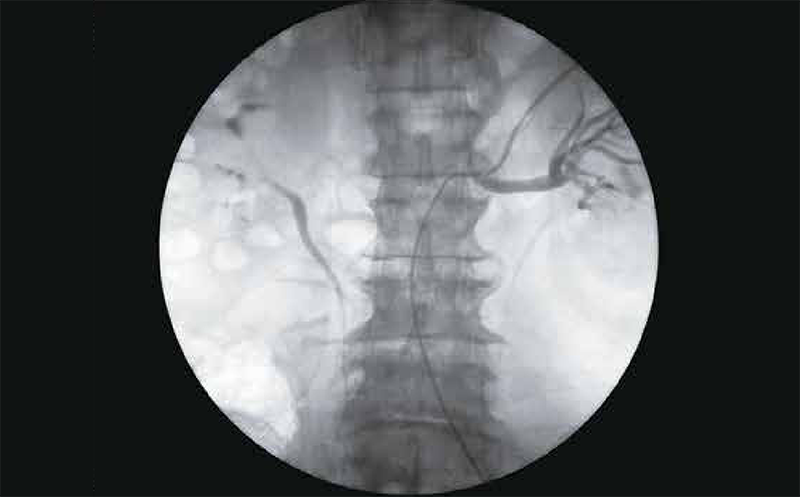 设备智能行走定位
