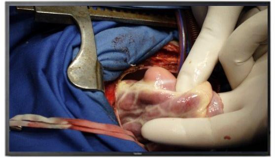 智慧数字一体化手术(杂交、导管)室概述